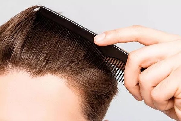 Mesotherapy for Hair Loss