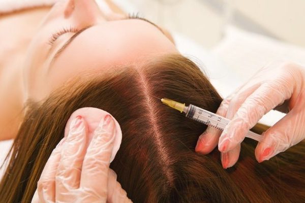 woman hair transplant