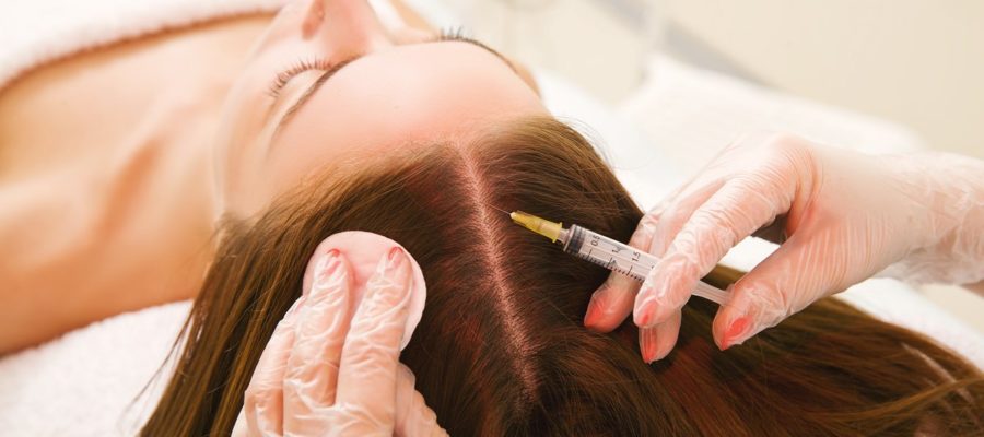 woman hair transplant